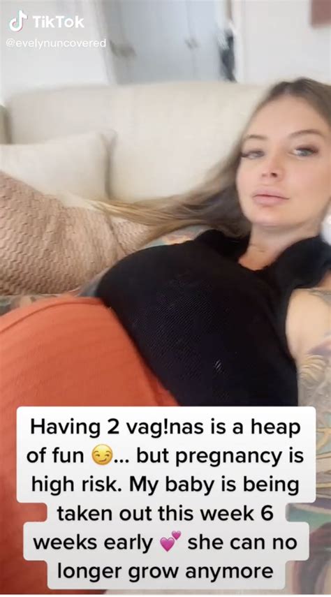 onlyfans model with 2 vaginas|The woman with two vaginas